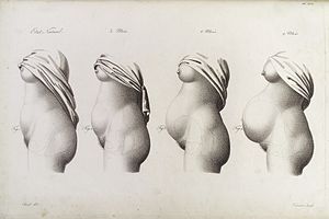 Stages in pregnancy as represented by the growth of the womb Wellcome L0038225.jpg